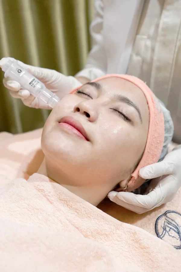 Mochi Skin Treatment